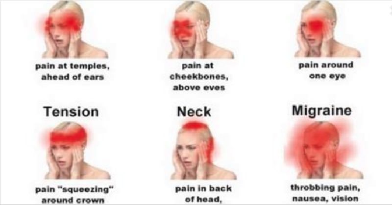 Headache Area And Its Meaning 