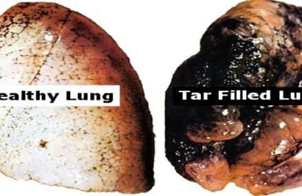 The lung-cleansing drink that anyone who smokes or who has ever smoked needs to try