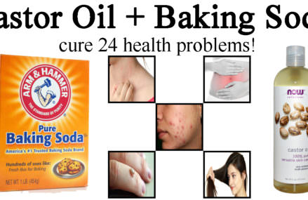 Castor Oil and Baking Soda Can Treat More Than 24 Health Problems!